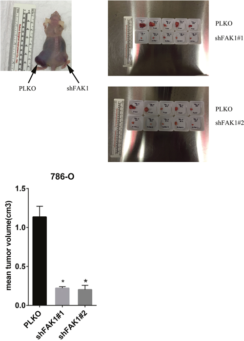 Ablation of FAK1 in 786-O cells decreases tumor growth in mouse xenografts.