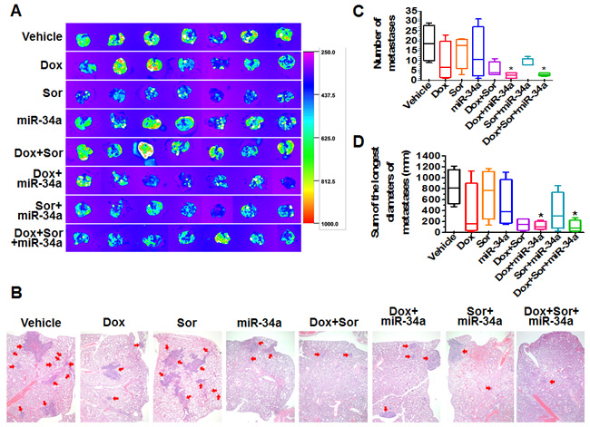 Doxorubicin, sorafenib and miR-34a triple-drug therapy sharply reduced pulmonary metastases from orthotopic osteosarcomas in mouse models.