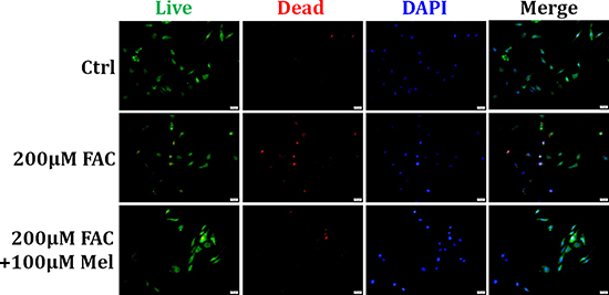 Protective effect of melatonin on FAC-induced cell death of BMSCs.