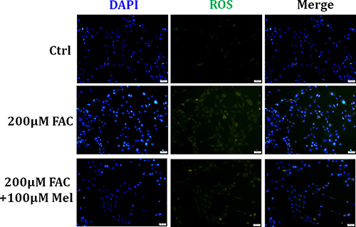 Melatonin protected BMSCs against FAC-induced intracellular ROS increase.