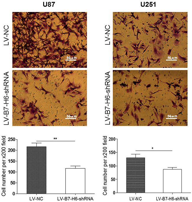 Effect of B7-H6 knockdown on the invasive ability of glioma cells.