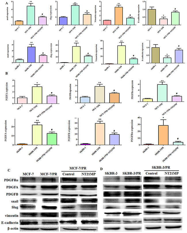 Effect of NT21MP on MCF-7 and SKBR-3 cell drug resistance.