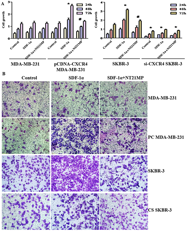 Effect of CXCR4 on cell proliferation and migration abilities.