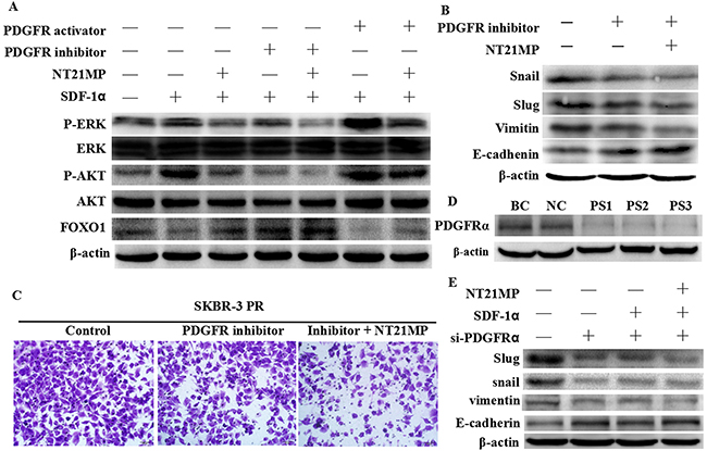 Inhibition of PDGFR&#x03B1; enhances the effect of NT21MP-reversed EMT and invasion in SKBR-3 PR cells.