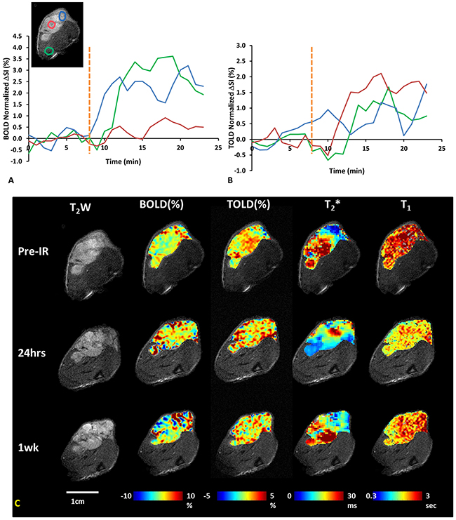 Oxygen sensitive MRI of a representative A549 lung tumor with respect to irradiation.