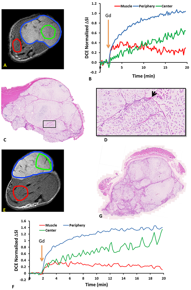 DCE dynamic curves and H&#x0026;E staining revealed intra-tumor heterogeneity in both control and irradiated subcutaneous A549 human lung tumor xenografts.