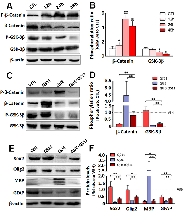 QUE inhibits Wnt/catenin signaling during differentiation of GSCs.