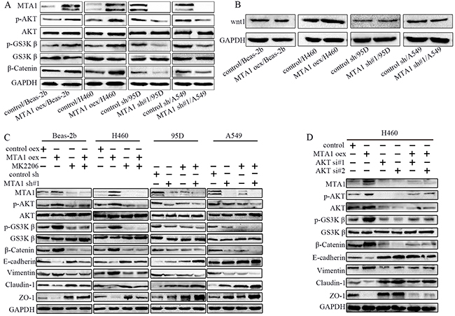 MTA1 promotes NSCLC cell EMT through the AKT/GSK3&#x03B2;/&#x03B2;-catenin signaling pathway.