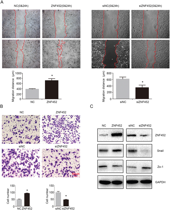 ZNF452 promoted migration and invasion of NSCLC cells.