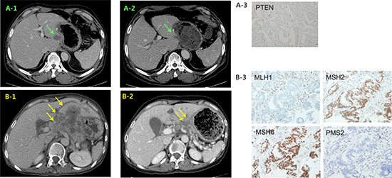 Representative clinical responses in the matched group.