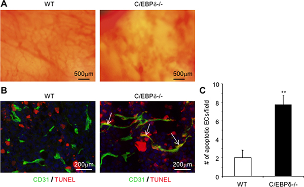 Loss of C/EBP-&#x03B4; results in increased endothelial apoptosis and hemorrhagic vascular morphology in tumors.