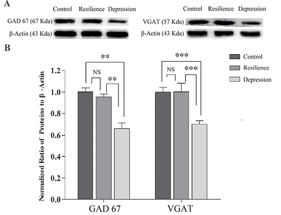 GABA synthesis, uptake and release are impaired in the nucleus accumbens of CUMS-induced depression mice, but not resilience mice.