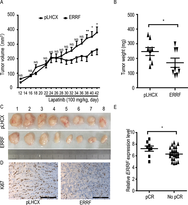 ERRF expression sensitizes xenograft breast cancer to the therapeutic effect of lapatinib and predicts response to lapatinib in breast cancer patients.