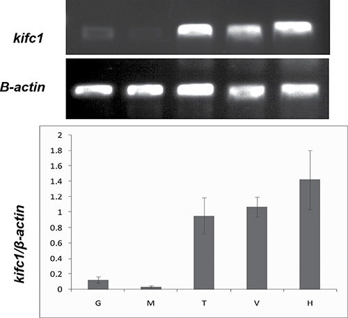 Semi-quantitative RT-PCR analysis of kifc1 mRNA levels among different tissues.