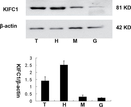 The KIFC1 protein expression levels among P. clarkii tissues.