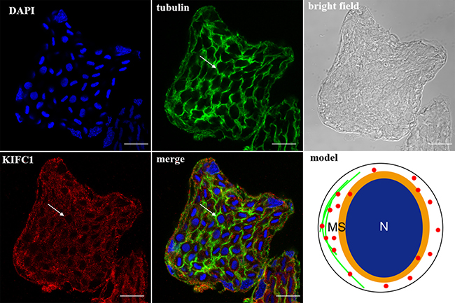 KIFC1 and microtubule expression pattern in early-stage spermatid.