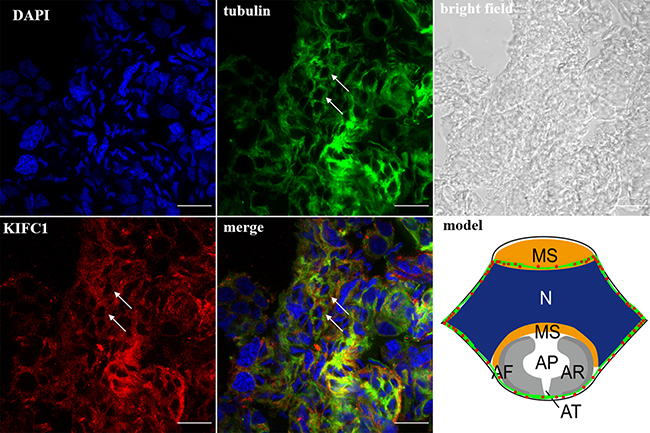 KIFC1 and microtubule expression pattern in late-stage spermatids.