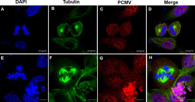 Effects of P. clarkii kifc1 overexpression on GC1 cell mitosis.