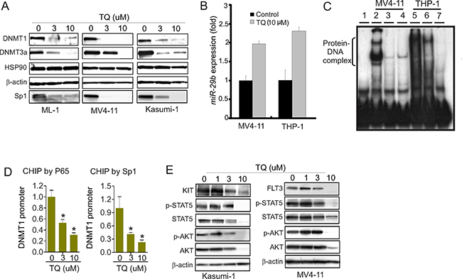 Treatment with TQ suppresses DNMT1 expression.