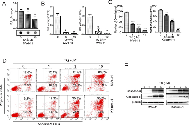 TQ inhibits DNA methylation and blocks leukemia growth in vitro.