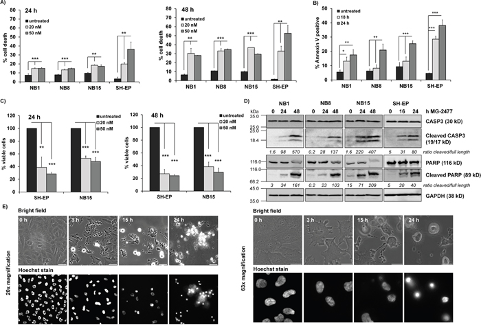 MG-2477 induces cell death in different neuroblastoma cell lines.