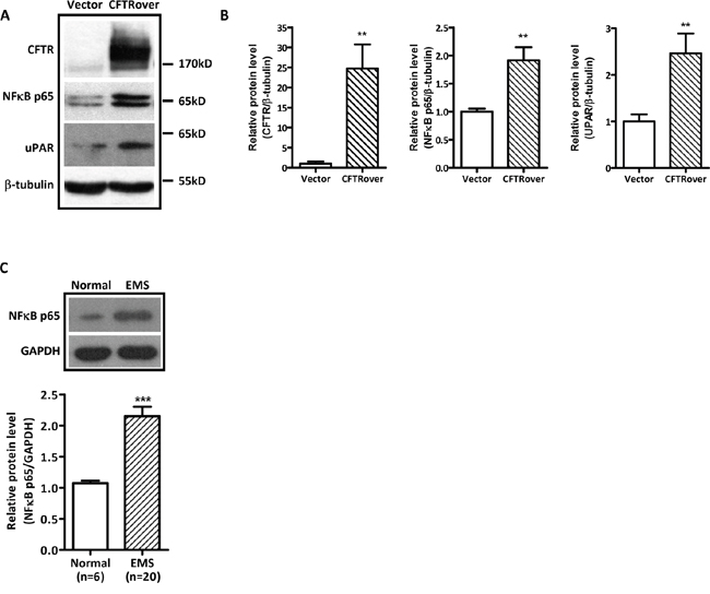 Effect of CFTR overexpression on NF&#x03BA;B p65 and uPAR expression in ISK cells.