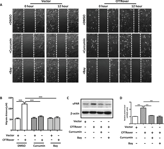 NF&#x03BA;B inhibitors reduce cell migration and uPAR expression in CFTR-overexpressing ISK cells.