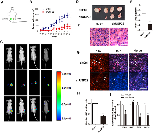 USP22 silencing suppresses tumor growth in GC xenografts in vivo.