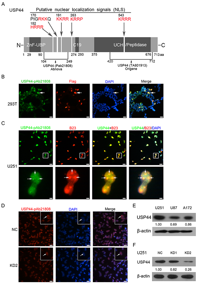 Antibody identification and intracellular localization of USP44.