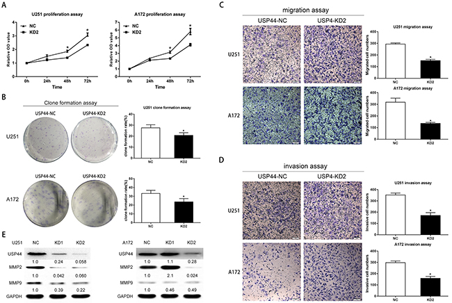 Knockdown of USP44 inhibit malignant biological behavior of glioma cells in vitro.