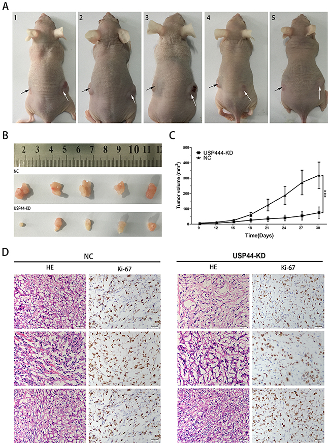 Downregulating USP44 inhibited the tumorigenesis in vivo.