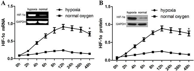 Hypoxia induces HIF-1&#x03B1; expression in aortic SMCs.