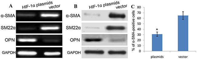 HIF-1&#x03B1; promotes phenotype switch of aortic SMCs.