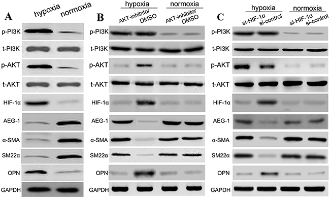 Hypoxia induces PI3K, p-PI3K, AKT, p-AKT and suppressed AEG-1 by HIF-1&#x03B1;.