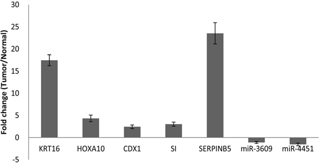 qRT-PCR analysis of KRT16, HOXA10, CDX1, SI, SERPINB5, miR-3609, and miR-4451 in PDAC.