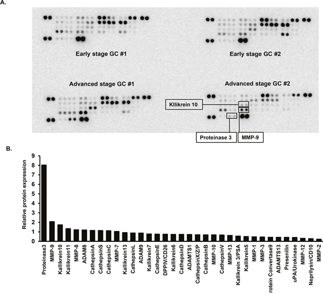 Protease array analyses of urine samples.