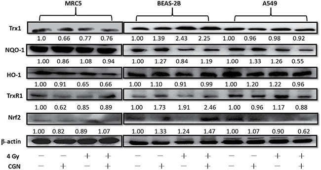 Down-regulation of the antioxidant defense system in cancer cells and up-regulation in normal cells after pretreatment with CGN and/or irradiation.