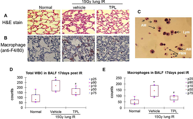 TPL reduced AMs in lung tissue and BALF at 17 days after thoracic irradiation.