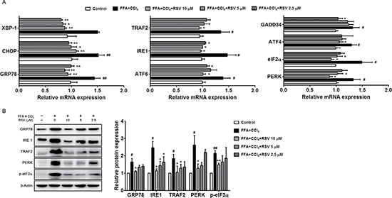 The effect of RSV on ER stress related molecules.