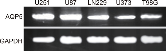 The mRNA expressions in U87-MG, U251, U373, T98G and LN229 cells detected by qRT-PCR.