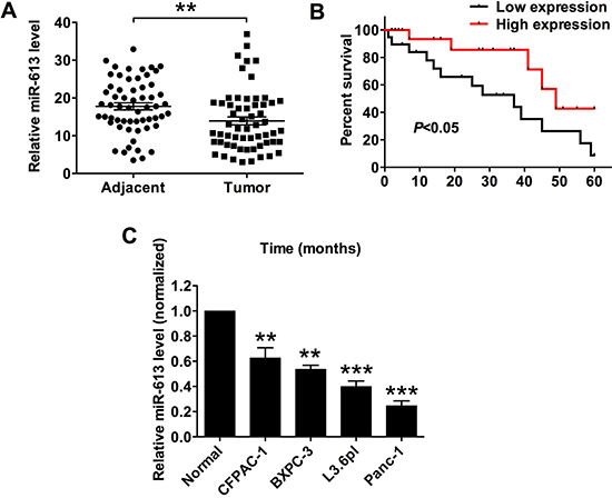 MiR-613 was down-regulated in pancreatic cancer tissues and cancer cells, and was correlated with poor survival in patients with pancreatic cancer patients.