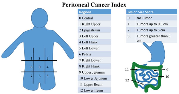 Peritoneal Cancer Index (PCI) scoring system.