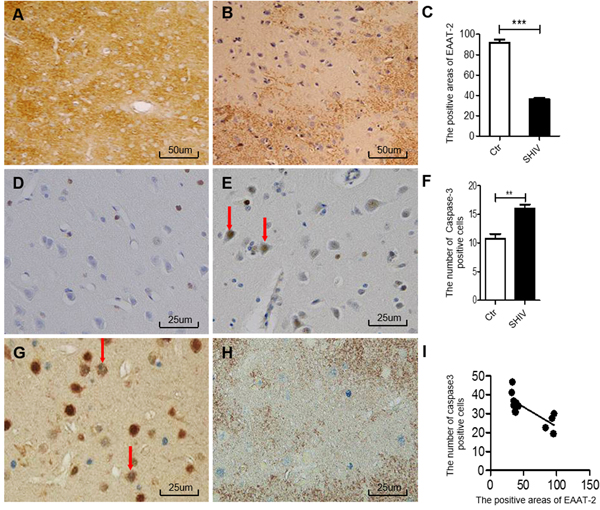 Association between decreased EAAT-2 and neuronal apoptosis in the cerebral cortex of SHIV-infected macaques.