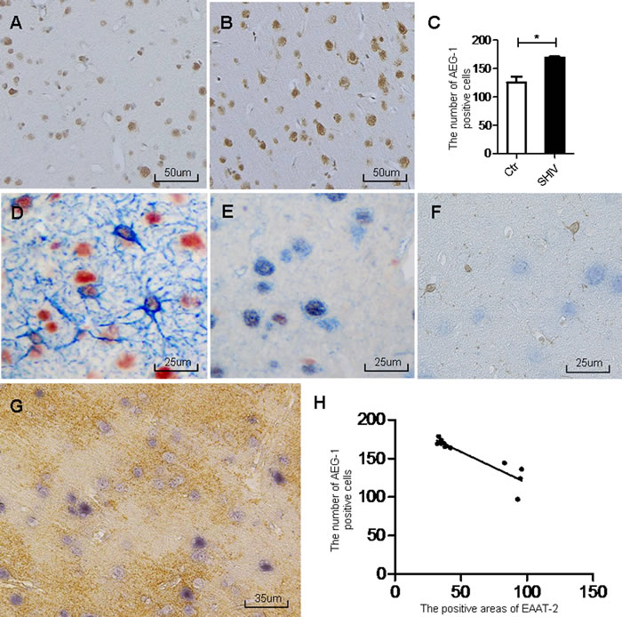 Increased AEG-1 expression in area of decreased EAAT-2 in the cerebral cortex of SHIV-infected macaques.