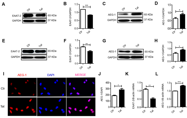 HIV-1 Tat decreases EAAT-2 expression and increases AEG-1 expression