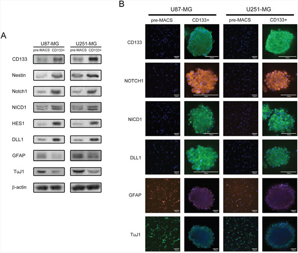 CD133+ U87-MG and U251-MG human GBM formed neurospheres exhibit higher stem cell marker expression, Notch activity, and elevated self-renewal abilities.