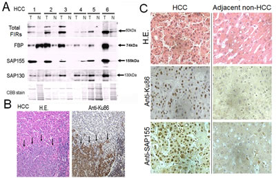 FIR, SAP155, and Ku86 were upregulated in human hepatocellular carcinoma (HCC) tissues.