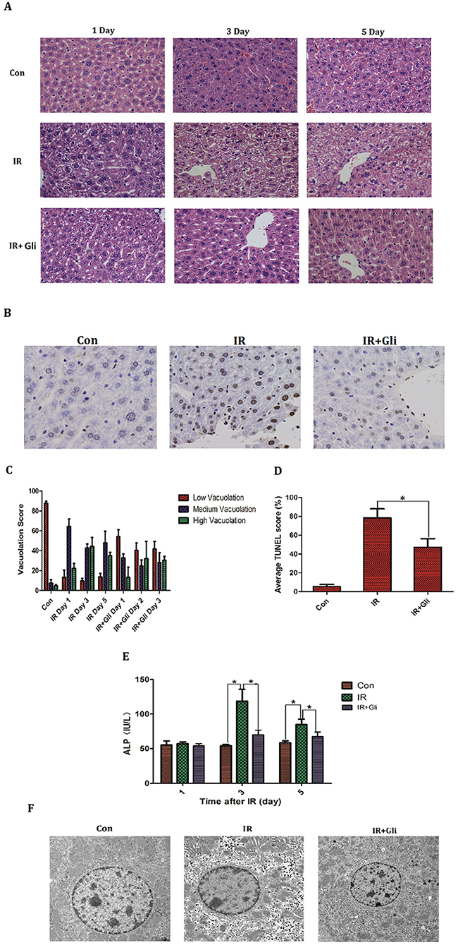 Glibenclamide remitted acute radiation-induced liver injury of mice.