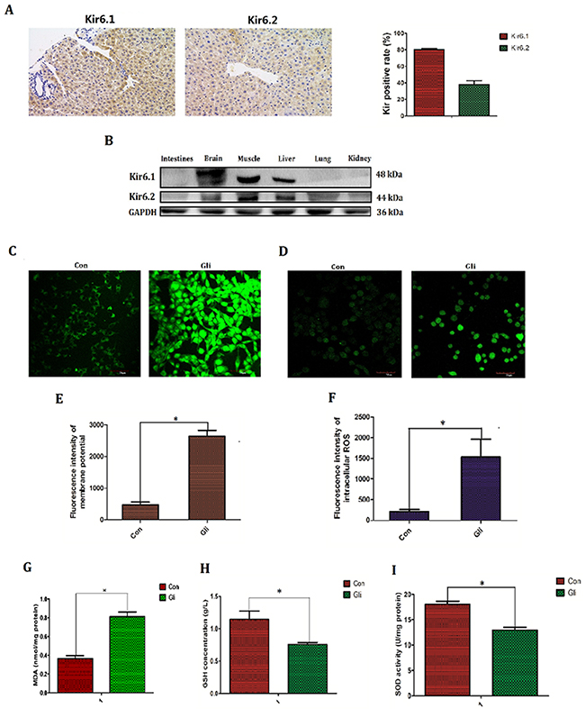 Glibenclamide elevated membrane potential and subsequently increased reactive oxygen species.