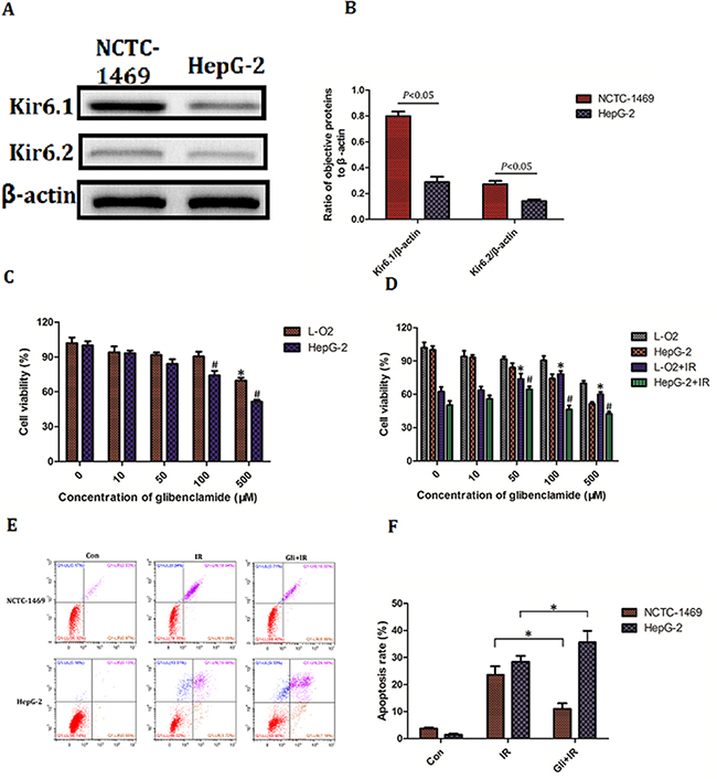 Effect of glibenclamide on hepatoma carcinoma cell.